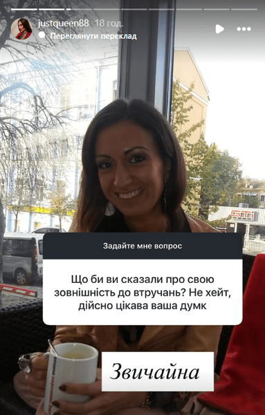 Украинка с самыми большими скулами в мире