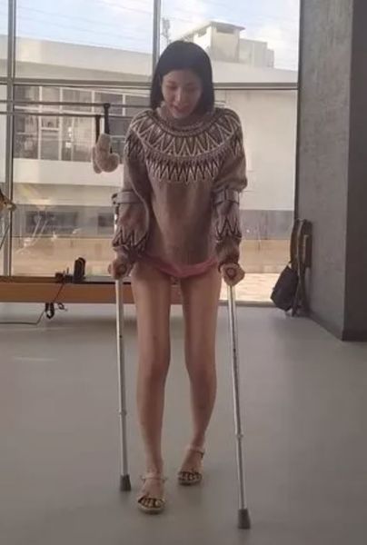 Як збільшити свій зріст, шляхи збільшення росту, операція, хірургічним шляхом стати вищим