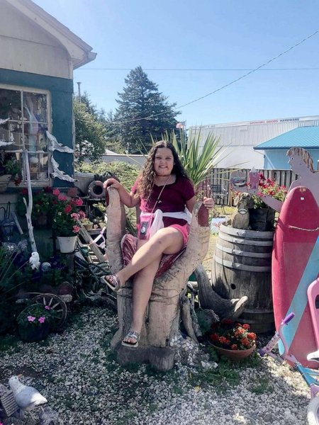 подросток, ожоги, челлендж