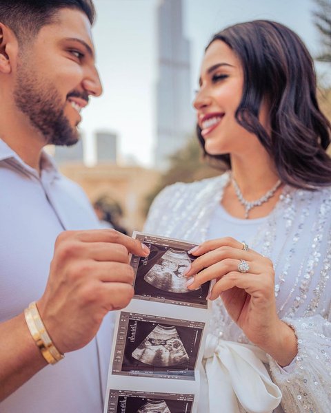 Беременность дубайской домохозяйки, жена миллионера, жизнь богатых, Дубай, фото
