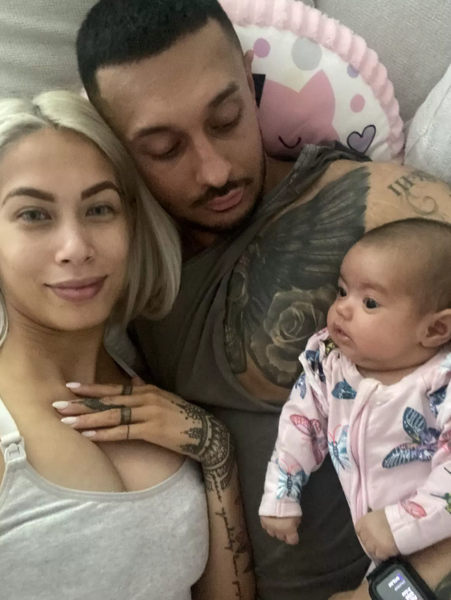 Волосся по всьому тілу в немовлят, зовнішність, дефекти, курйози, пологи, народження дітей, фото, Австралія