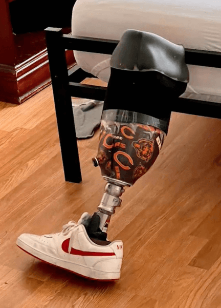 Самолет, протез, протез ноги, American Airlines, утерянный багаж, потеряли протез