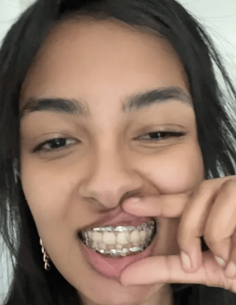 Джаверия с фиксаторами