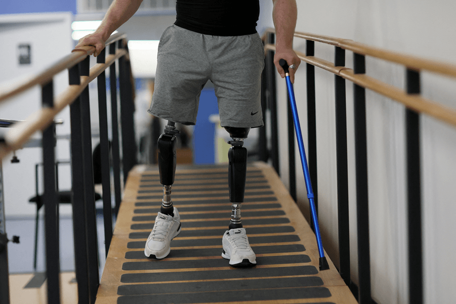 Протезирование украинских защитников