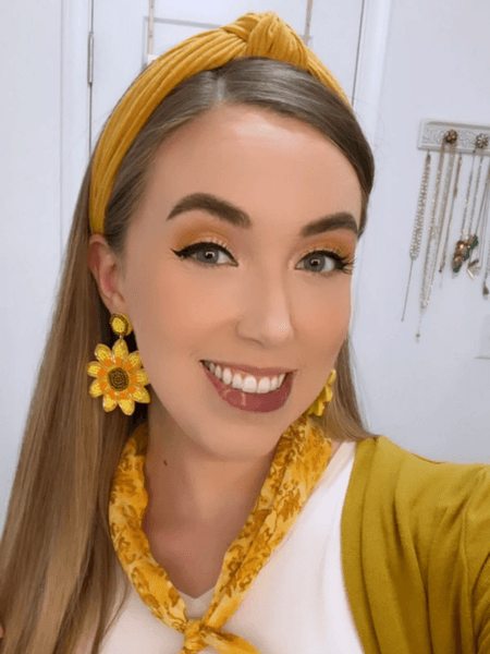 Девушка перенесла 20 операций, родимое пятно, аномалия на лице, редкая болезнь, кровеносные сосуды, пятно на лице, операция