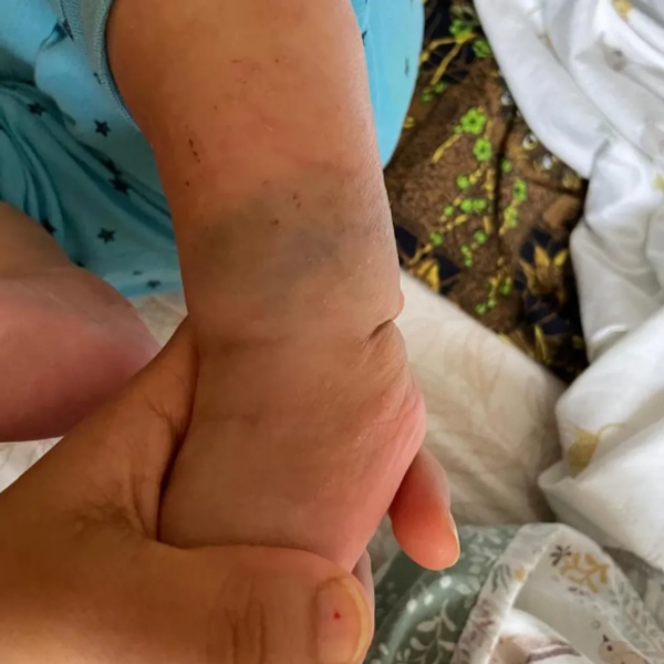 Мать попала за решетку из-за родинки на теле сына, Лаксми Тапа, Великобритания, курьезы во время медицинского осмотра, фото