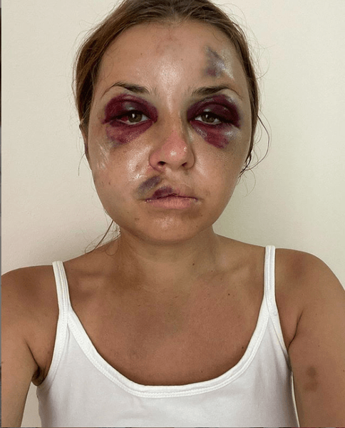 анастасия луговая, нападение