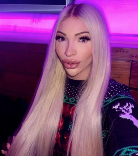 Идеал красоты Мэрилин Монро, Серена Смит из Беверли-Хиллз, пластические операции, внешность, хирургические вмешательства