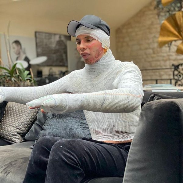 Олів'є Рустам в бинтах