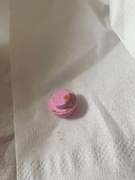 Мужчина прожил 20 лет с деталью от конструктора в ухе, что он чувствовал, интересные истории, странные случаи из жизни