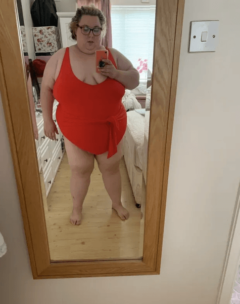 Жінка схудла на 120 кг, зайва вага, швидке схуднення, фото до і після, операція для схуднення, важила 190 кг,