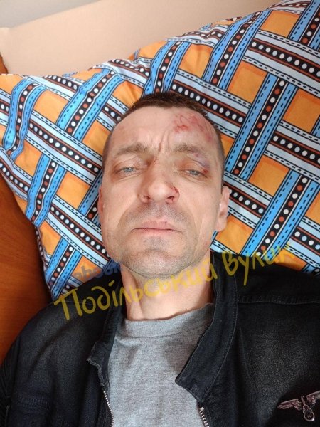 військовий побиття Чоловік написав заяву до поліції