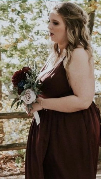 Жінка скинула вагу, рідкісний діагноз, рідкісна хвороба, дізналася через Facebook, випадкове відео змінило життя, страждала від сильного болю