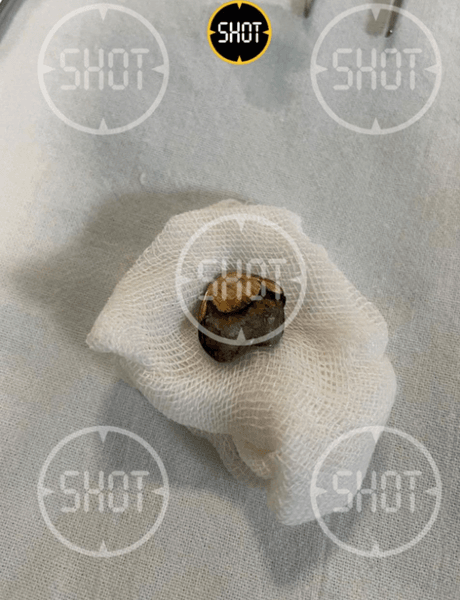 куля, Тимур Бекмансуров, пермський стрілок, реанімація