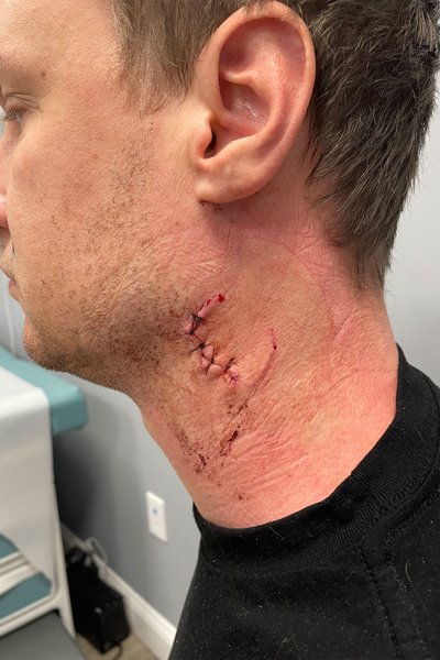 драка в баре, украинец зарезал соотечественника, драка между украинцами в сша, драка в нью-йорке, драка украинцы нью-йорк, драка украинцы бруклин, драка в баре бруклин, драка в баре нью-йорк, мелешков