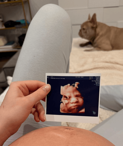 Марго Дидович, беременность в Чили