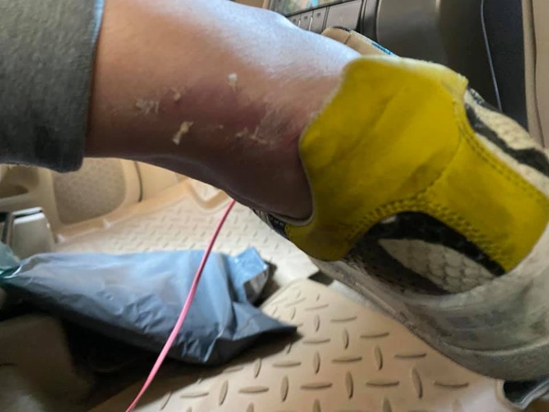 Наталья Влащенко попала в ДТП, Влащенко попала в аварию