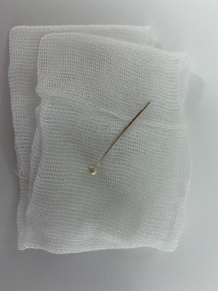 Детские врачи, иголка у ребенка, достать иголку, иголка в горле, детская операция