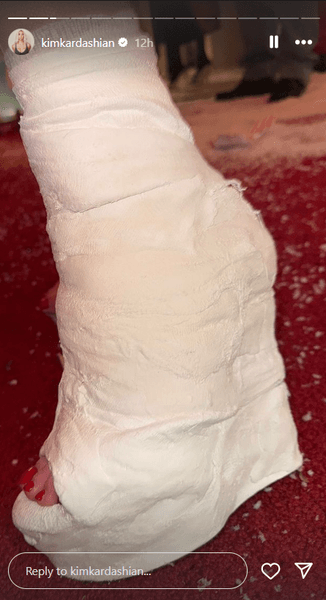 гипс Ким Кардашьян