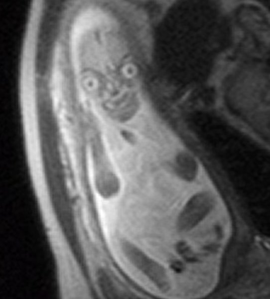 дитина скан мрт