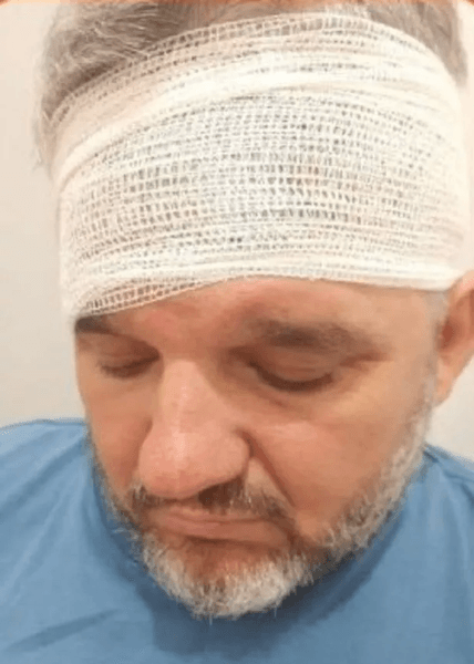 Хворий чоловік, чоловік, личинки у вусі, яйця у вусі, операція, лікарня, муха відклала яйця