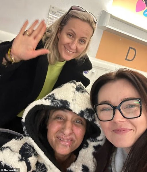 Жінка з Великої Британії втратила всі кінцівки після того, як важкий сепсис різко ускладнив її стан