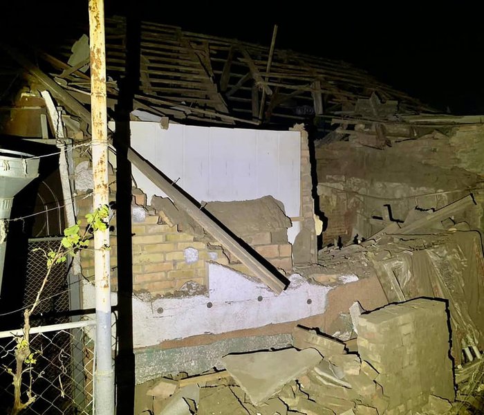 6-річна дівчинка втратила обидві ноги через обстріл Нікополя