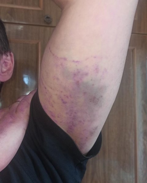 конфлікт із ТЦК, скандал із ТЦК, ТЦК у Світловодську, Світловодськ, ТЦК побили чоловіка