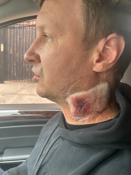 драка в баре, украинец зарезал соотечественника, драка между украинцами в сша, драка в нью-йорке, драка украинцы нью-йорк, драка украинцы бруклин, драка в баре бруклин, драка в баре нью-йорк, мелешков