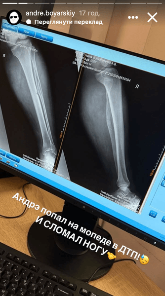 Андре Боярський, Боярський, Боярський блогер, ДТП, аварія, Боярський ДТП, Боярський аварія