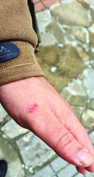 Чернігів, Спасо-Преображенський собор, УПЦ МП, священник покусав, покусав військового