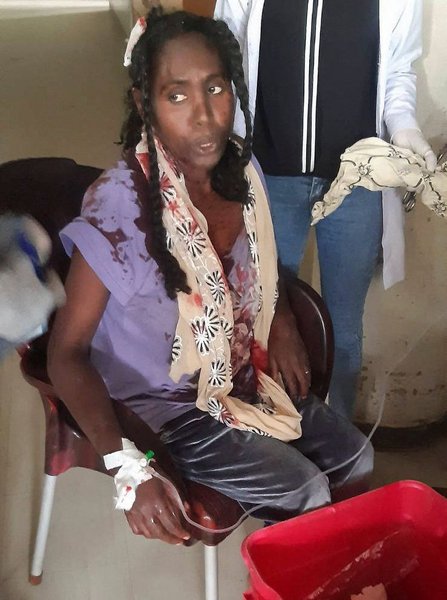 Авиаудар, Тыграй, Эфиопия, фото