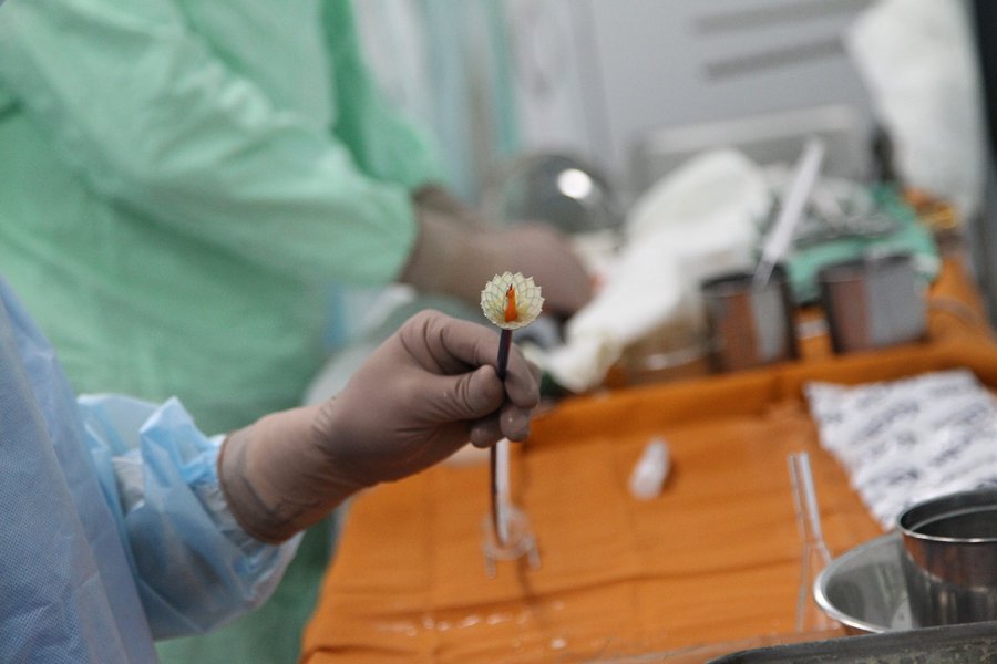 кардиохирургия, операция на сердце,