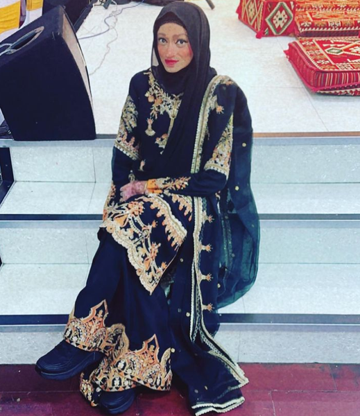 Захворювання шкіри, аномалії, дивні діагнози, зовнішність як Фредді Крюгера, фото, Велика Британія