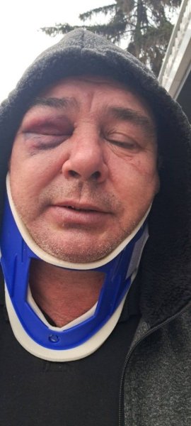 На Київщині працівники ТЦК жорстоко побили чоловіка на очах у поліції