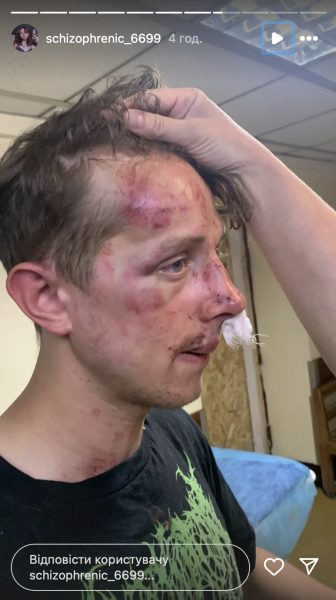 Побитий колишній військовий Зображення побитого колишнього військового