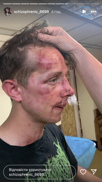 Изображение избитого бывшего военного