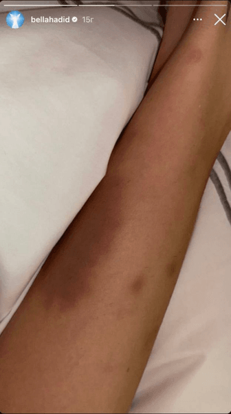 Белла Хадид