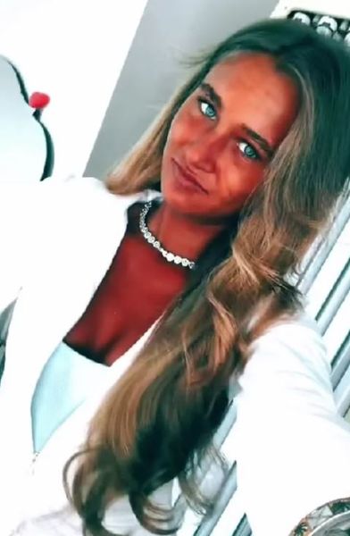 Меган Блейн из Великобритании, солярий, косметические процедуры, загар, курьезы, странные расстройства, аномалии