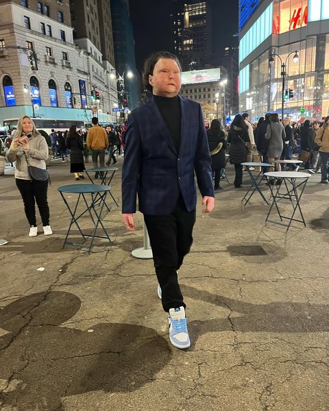 Джо ДиМео через несколько лет после ДТП