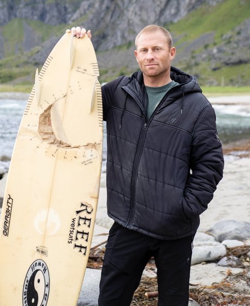 пострадавший от нападения акулы