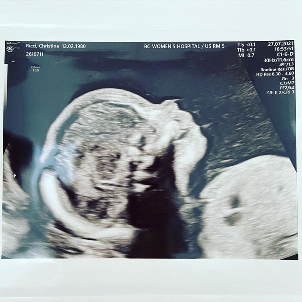 Крістіна Річчі, актриса, друга дитина