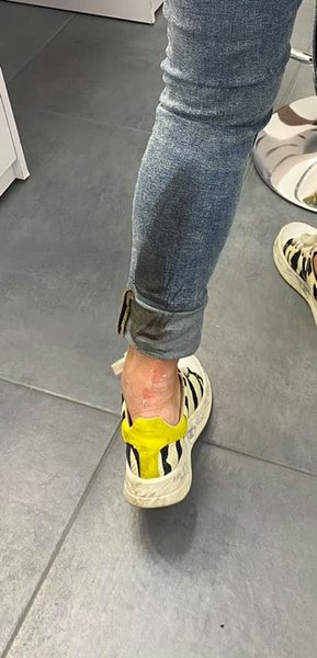 Наталья Влащенко попала в ДТП, Влащенко попала в аварию