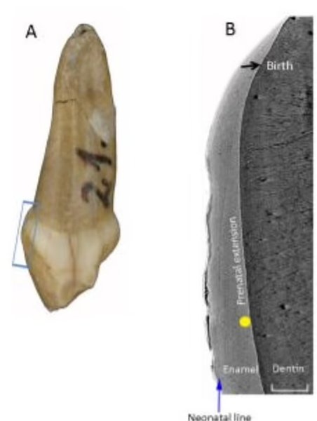 зуб, ребенок, неандерталец