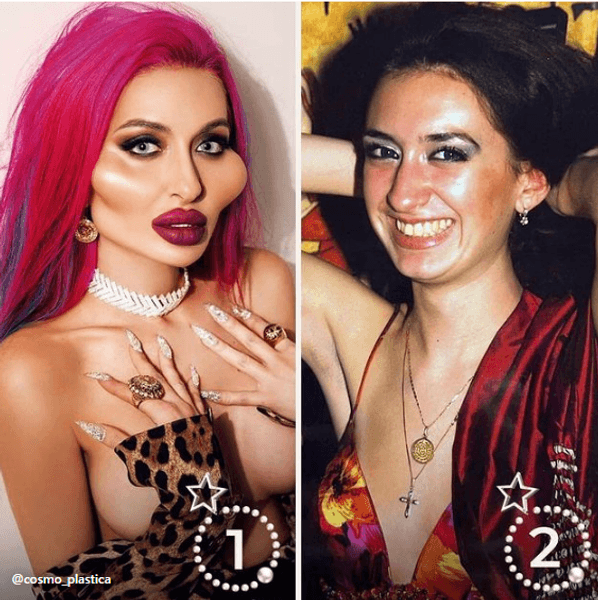 Анастасія Покрещук, Покрещук, блогерка, великі щоки