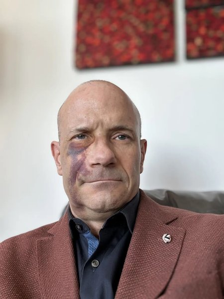 Эрик Золлингер