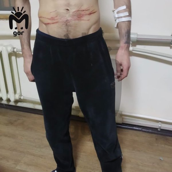 Порезы, нанесенные себе заключенными