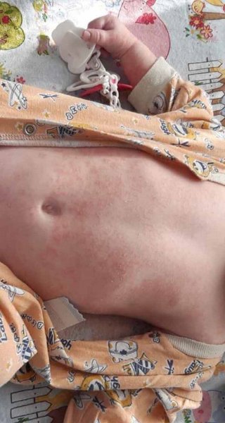 Младенец, ребенок