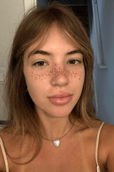 дівчина з веснянками