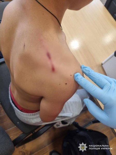 На Закарпатье школьник открыл огонь на уроке